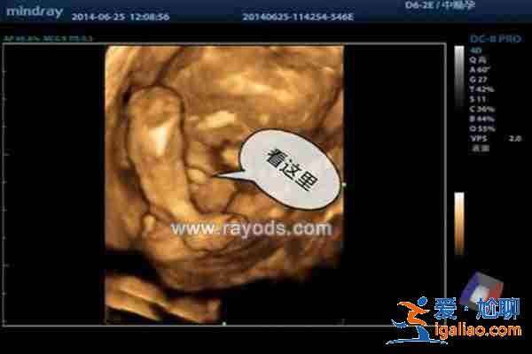 正規助孕包性別,第一助孕資訊? 正規助孕包性別,第一助孕資訊?