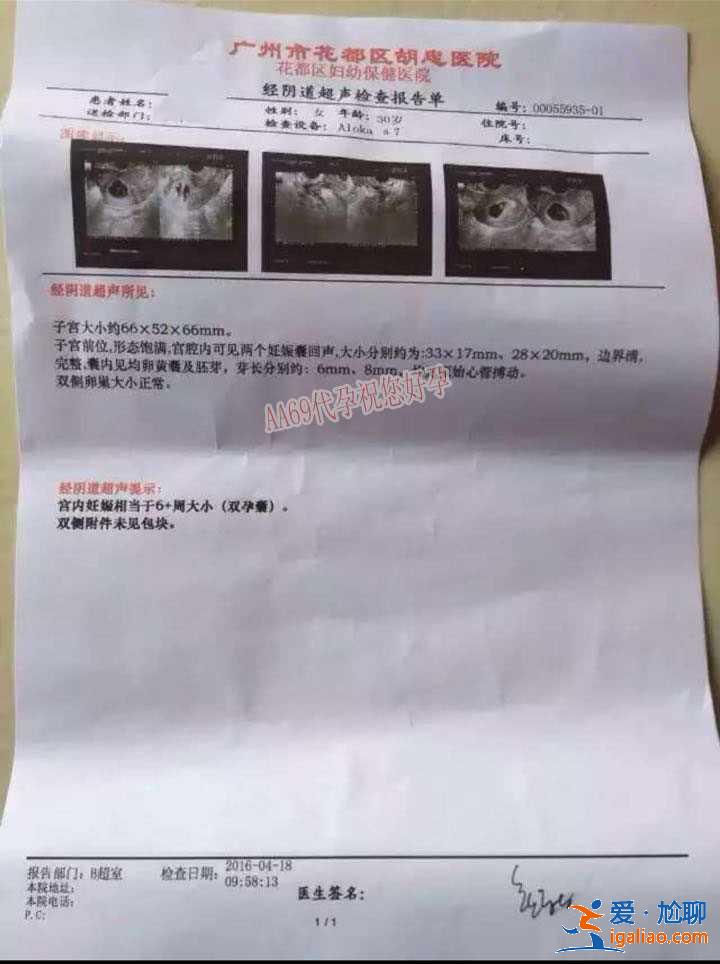 看一下蘭州最大的助孕公司,100%包成功？