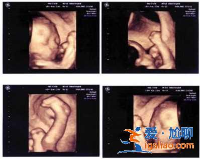 國內三代試管嬰兒多少錢,AA69助孕公司為您圓夢助孕? 國內三代試管嬰兒多少錢,AA69助孕公司為您圓夢助孕?