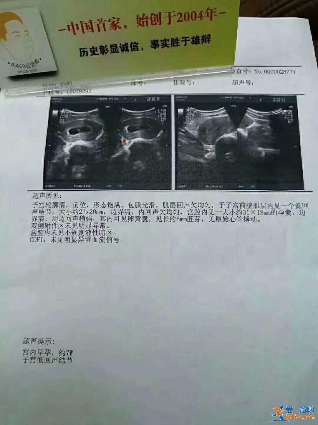 哈爾濱供卵助孕試管,怎樣才能做好優生優育？