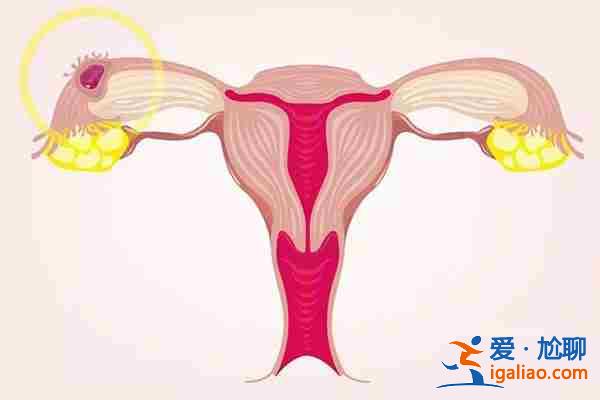 國內(nèi)代生孩子價(jià)格_供卵自懷? 國內(nèi)代生孩子價(jià)格_供卵自懷?