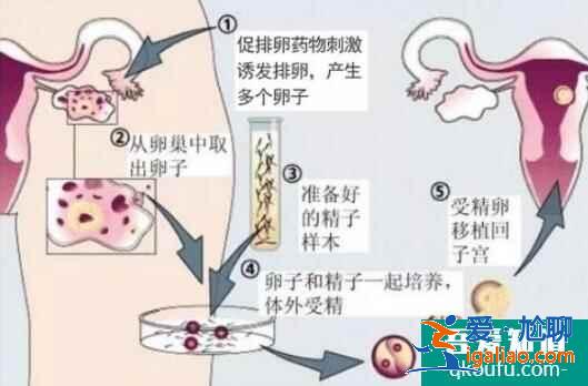 人工授精多次失敗后還可以做試管嬰兒嗎?？
