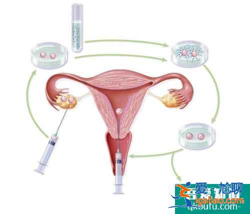 試管嬰兒的自然周期適合哪些人群？？