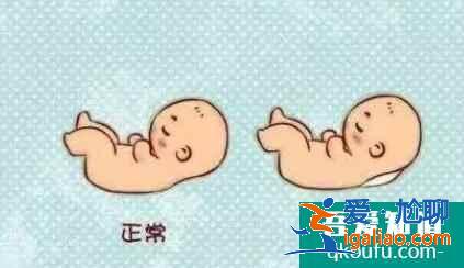 孕前nt檢查有必要嗎？？