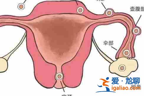 南通代生寶寶[ 技術介紹 ]？