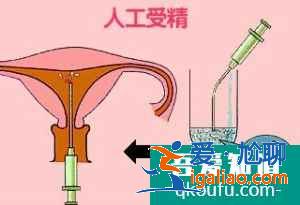 人工授精的過(guò)程是什么樣的？？