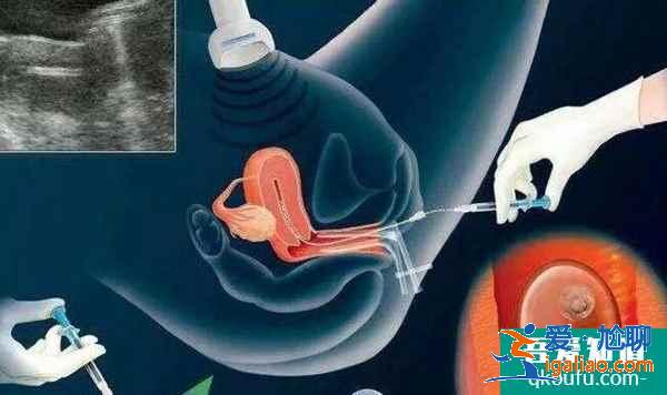 什么情況做第三代試管嬰兒?? 什么情況做第三代試管嬰兒??