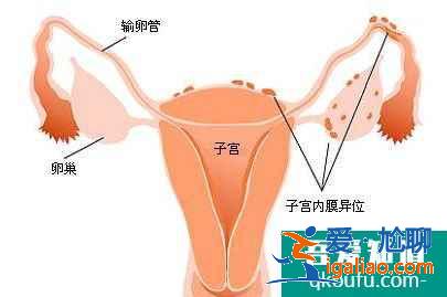 供卵試管嬰兒：高齡生子做第三代成功率高嗎？