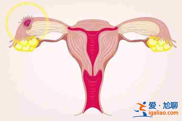代理孕母多少錢,針灸對助孕效果怎么樣? 代理孕母多少錢,針灸對助孕效果怎么樣?