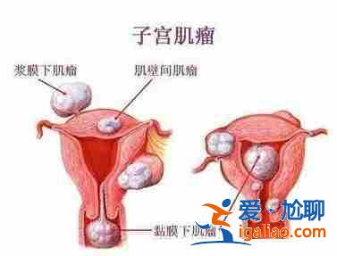 說一下北京代生懷孕公司【行業領跑】？