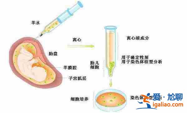 上海代生男孩費用-孕媽媽最值得信賴的助孕公司？