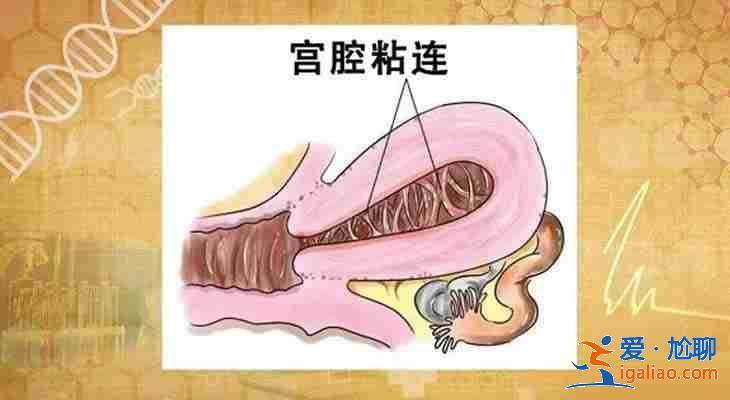 天津代生助孕[ 高端技術三甲助孕 ]？