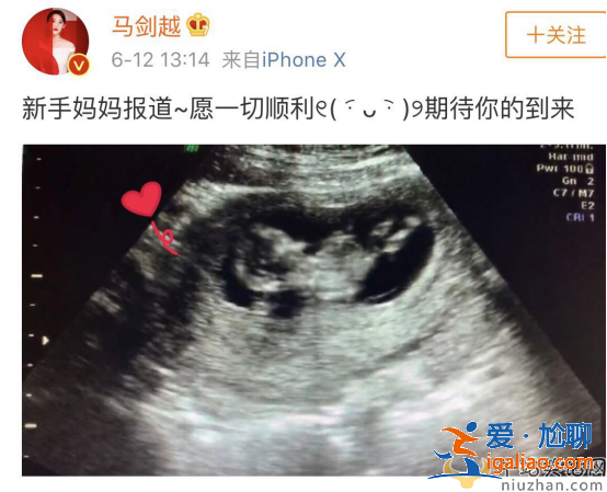 奇葩說辯論選手前女團成員馬劍越結婚不久宣布有孩子了！