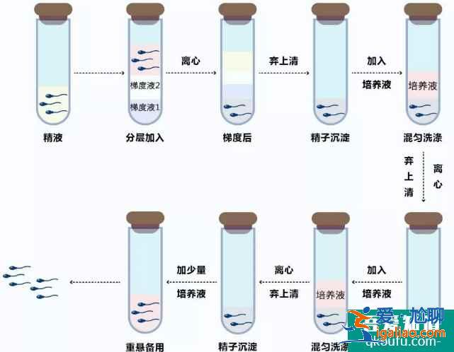 年輕女性做試管嬰兒，心理狀態是成敗的關鍵！？