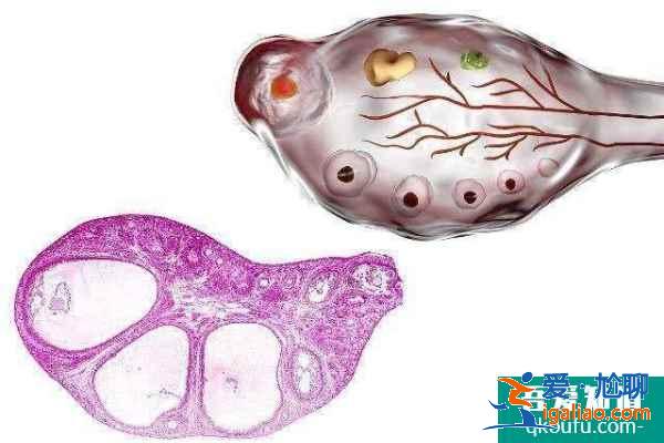 試管嬰兒為什么要打HCG?有什么用?? 試管嬰兒為什么要打HCG?有什么用??