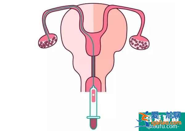 年齡與卵泡數(shù)量的關(guān)系，試管專家從5方面提高取卵個數(shù)？