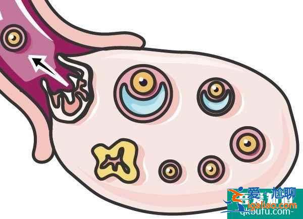 泰國試管嬰兒促排卵，會增加乳腺癌的患病幾率嗎?？