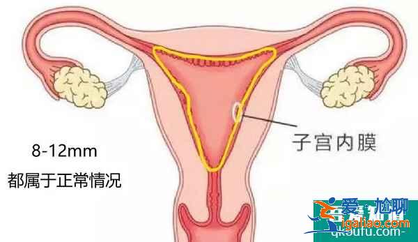 去做試管嬰兒，滿足什么樣的條件成功率更高？？
