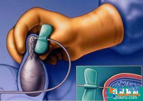 針對無精癥的問題，試管嬰兒有什么助孕方案？？