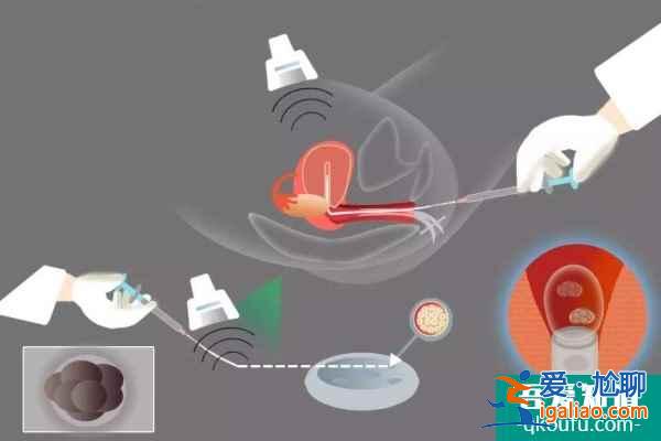 女性大于35歲,做第三代試管嬰兒成功率高嗎?? 女性大于35歲,做第三代試管嬰兒成功率高嗎??