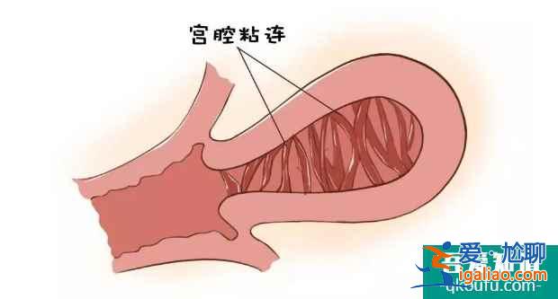 泰國試管嬰兒專家：探究引起不孕癥的原因與好孕方案？