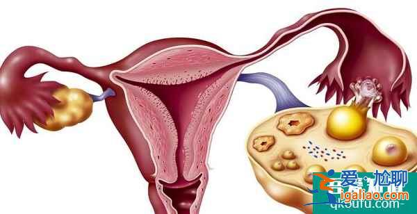 去泰國做試管嬰兒使用的促排藥安全嗎？？