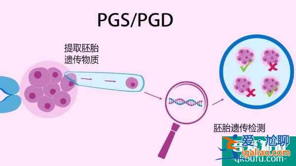先天性輸精管缺如，去泰國做試管嬰兒如何成就“爸”業(yè)？？