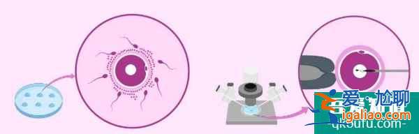 關于泰國試管嬰兒，常見的5個被誤傳的錯誤信息？