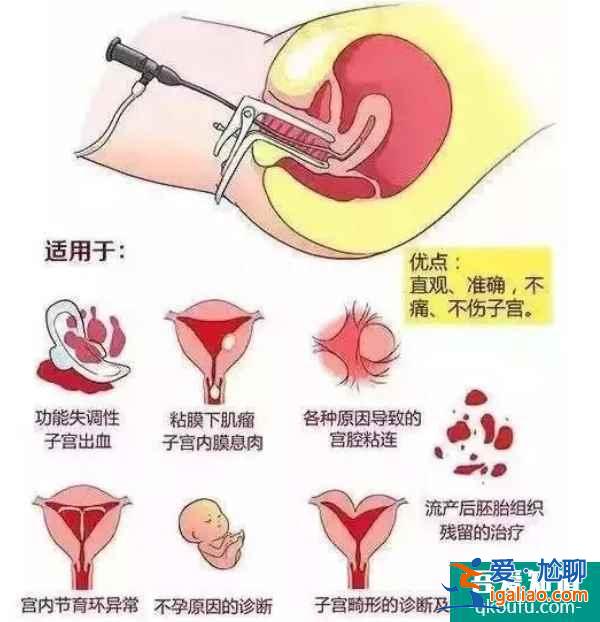 解惑：赴美做試管嬰兒還需要做宮腔鏡檢查嗎？？