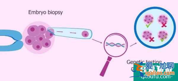 假性絕經(jīng)還能赴美做試管嬰兒嗎，赴美前的重點(diǎn)是什么？？