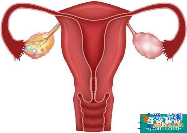 反復流產多與染色體異常有關?試管能解決嗎?? 反復流產多與染色體異常有關?試管能解決嗎??