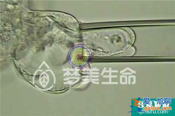 維生素D不足，從三方面提高試管嬰兒著床率？