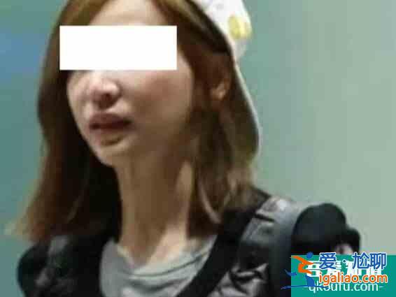 有些女明星為啥越做醫美越衰老？
