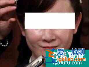 有些女明星為啥越做醫美越衰老？