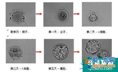 試管嬰兒胚胎評(píng)級(jí)與成功率之間有什么關(guān)系？？