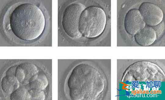 自然周期監(jiān)測(cè)卵泡的方法你都知道嗎？