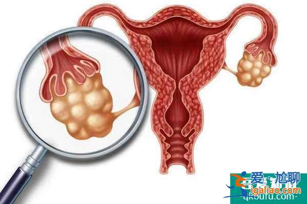解惑:多囊卵巢和卵巢過度刺激是一回事嗎?? 解惑:多囊卵巢和卵巢過度刺激是一回事嗎??