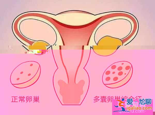 卵泡發育不良如何通過第三代試管嬰兒助孕成功？