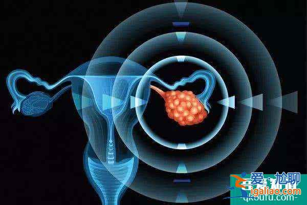 高齡不孕女性如何選對試管嬰兒方案？？