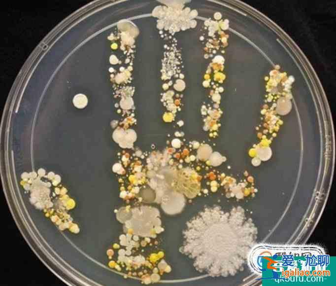 細菌菌落和真菌菌落的區別是什么?? 細菌菌落和真菌菌落的區別是什么??