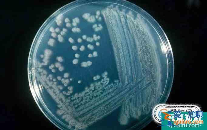 細菌菌落和真菌菌落的區別是什么?? 細菌菌落和真菌菌落的區別是什么??