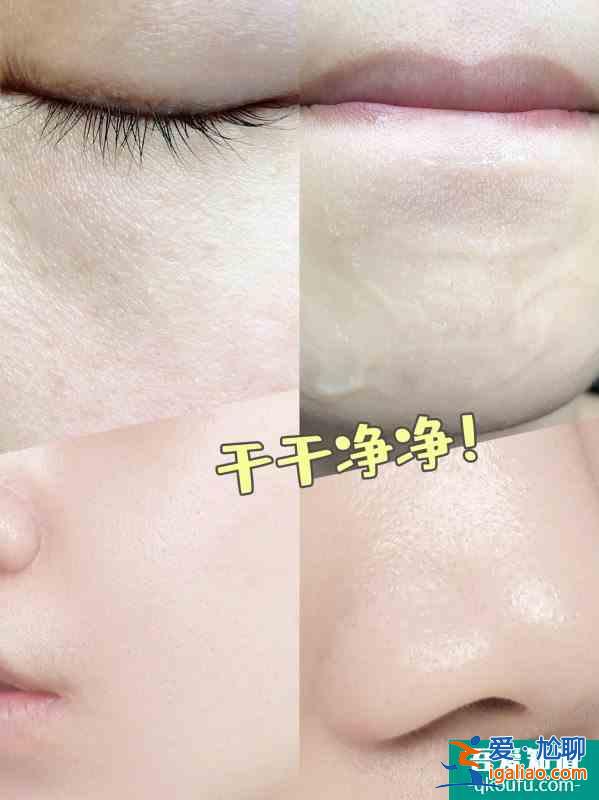 女明星的護(hù)膚方法解決了我的痘痘痘印問題！？