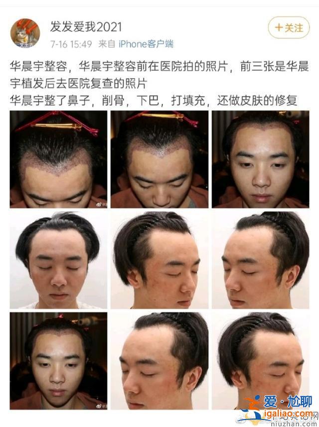 華晨宇22日曬紋身照  華晨宇整容照片曝光