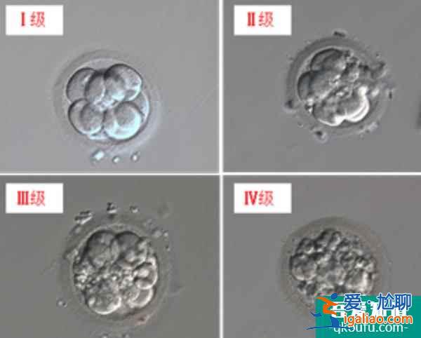 解析赴美做試管嬰兒胚胎級別與成功率的關系？