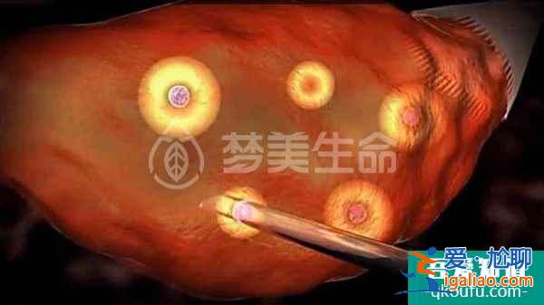 赴美試管嬰兒流程詳細分解，完善攻略推薦!？