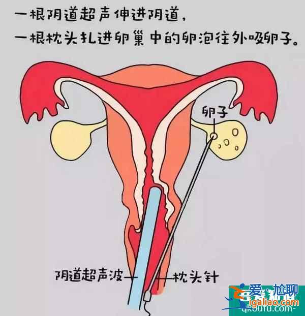 試管嬰兒寶寶能自然分娩嗎？誕生歷程是怎樣？？