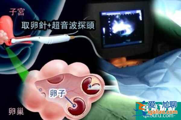 警惕地下機(jī)構(gòu)背后的潛在風(fēng)險(xiǎn)？