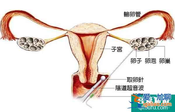 試管嬰兒安全無痛周期，體現在四個方面？