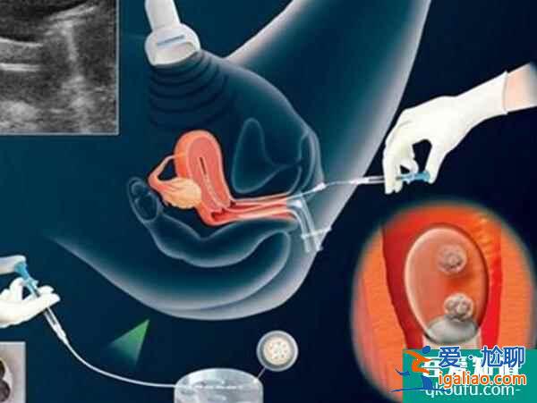 試管嬰兒：凍胚移植優點有哪些？？