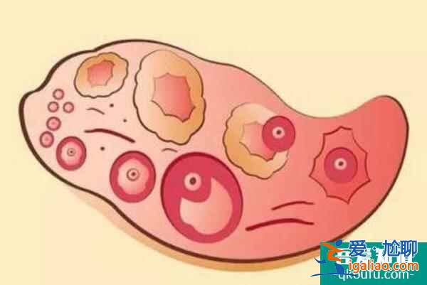 絕經后赴美做試管嬰兒，還能取到健康卵子嗎？？